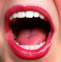 5 dažniausiai užduodami klausimai apie dantų balinimą